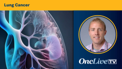 Dr Durm on Perioperative Treatment Strategies in Early-Stage NSCLC