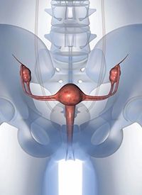gynecologic cancer
