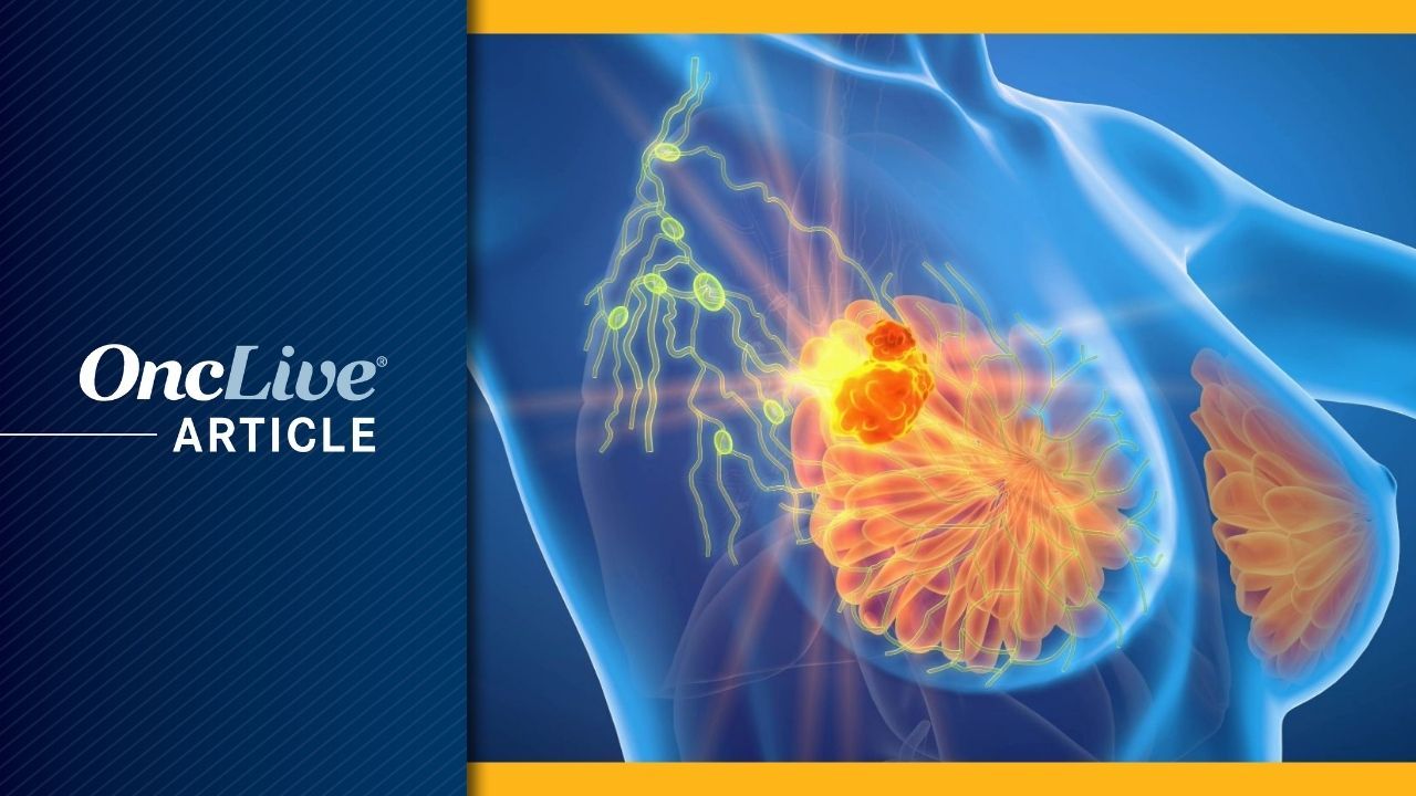 ER+/HER2– breast cancer | Image Credit: © Axel Kock - stock.adobe.com