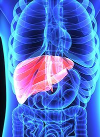 Cholangiocarcinoma