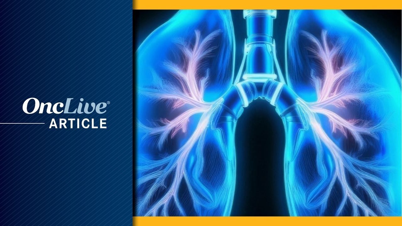 <![CDATA[WVU Medicine First in West Virginia to Use Pulse Electric Field Therapy to Treat Metastatic Lung Nodules]]>