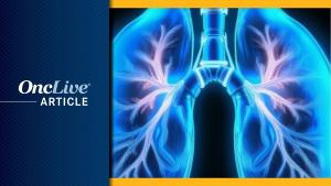 Lung cancer | Image by Ashling Wahner & MJH Life Sciences Using AI