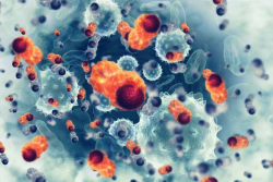 Non-Melanoma Skin Cancer: Deep Dive into Treatment Strategies for Cutaneous Squamous Cell Carcinoma