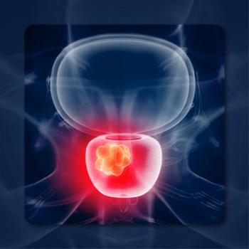 Illuccix PSMA-PET Imaging in Prostate Cancer | Image Credit: © Sebastian Kaulitzki – stock.adobe.com