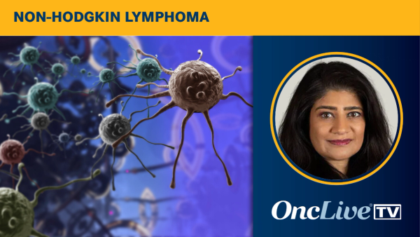 Sonali M. Smith, MD, discusses implications of data for tafasitamab plus lenalidomide/R-CHOP in high-risk diffuse large B-cell lymphoma.