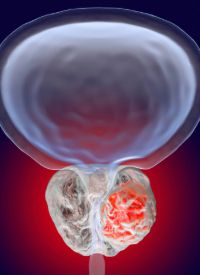 CRPC | Image credit:   © Dr_Microbe - stock.adobe.com