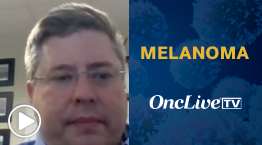 Michael A. Davies, MD, PhD, of The University of Texas MD Anderson Cancer Center