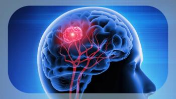 Brain Metastases | Image credit: © peterschreiber.media - stock.adobe.com