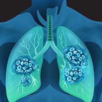 Lung Cancer © blueringmedia - stock.adobe.com