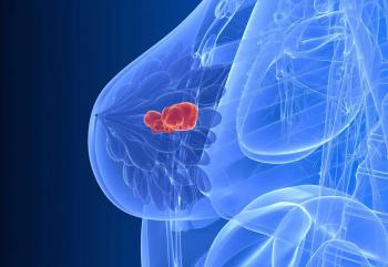 Translating Evidence to Clinical Practice: Oral SERDs in HR+/HER2– Metastatic Breast Cancer
