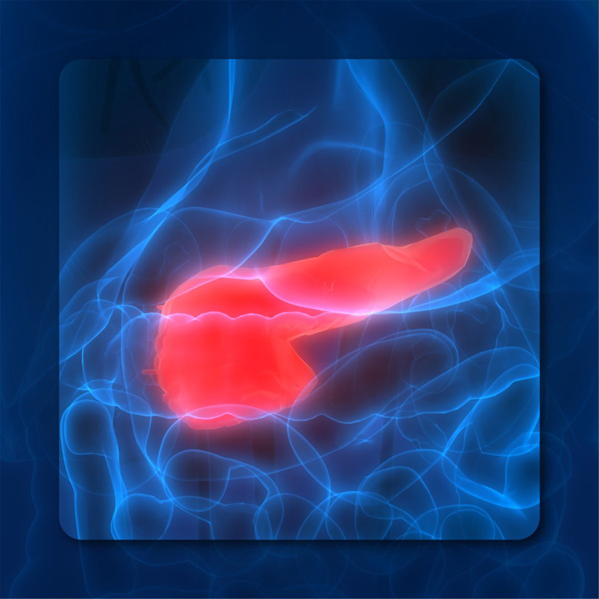 SON-1010 in Solid Tumors | Image Credit: © magicmine – stock.adobe.com