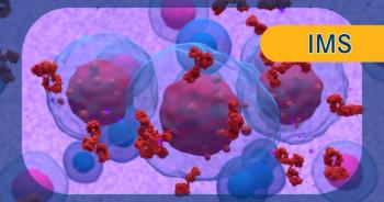 Isa-KRd in multiple myeloma:  © LASZLO - stock.adobe.com