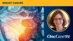 Effects of Patient Navigation on Breast Cancer Screening | Image Credit: © Rasi - stock.adobe.com