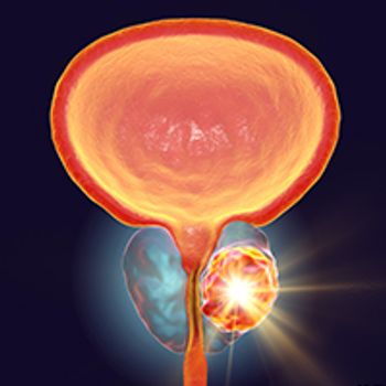 Prostate Cancer | Image Credit: © Dr_Microbe - stock.adobe.com