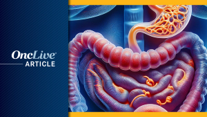 Gastric/GEJ Adenocarcinoma | Image Credit: © Ashling Wahner & MJH Life Sciences Using AI