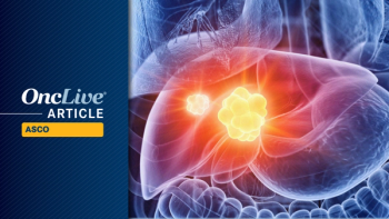 Cholangiocarcinoma © vitanovski - stock.adobe.com
