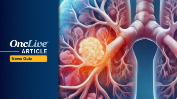 Did you catch all of this week's top oncology news? Test your knowledge with OncLive's Weekly News Quiz.