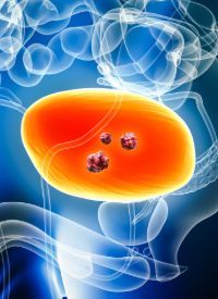 Urothelial Carcinoma |  Image Credit: © Matthieu  - stock.adobe.com
