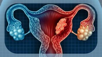 Cervical Cancer | Image Credit: © freshidea - stock.adobe.com