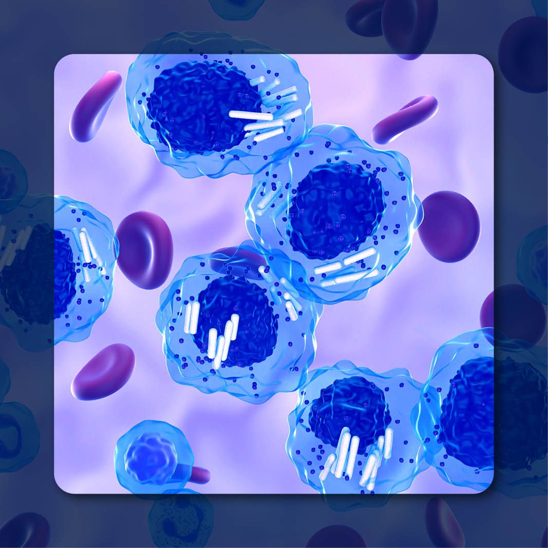 Chronic Lymphocytic Leukemia |Image Credit: © LASZLO – stock.adobe.com