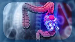 Health Canada Approves Nivolumab Plus Ipilimumab for Unresectable MSI-H/dMMR CRC and Unresectable HCC