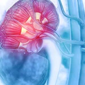 Cabozantinib Plus Nivolumab/Ipilimumab Shows Notable PFS Improvement in Intermediate-Risk, Advanced RCC