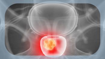 Prostate Cancer | Image Credit: © Sebastian Kaulitzki - stock.adobe.com