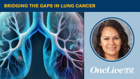 Bridging the Gaps in Lung Cancer | Image Credit: © Ashling Wahner & MJH Life Sciences Using AI