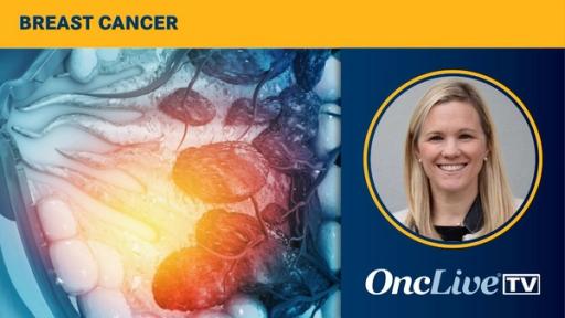Dr Flanagan on the Importance of Multidisciplinary Breast Cancer Tumor Boards