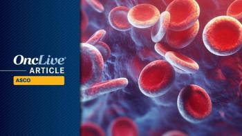 DLBCL | Image Credit: © Oleksandr - stock.adobe.com