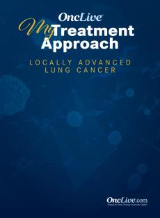 My Treatment Approach: Locally Advanced Lung Cancer