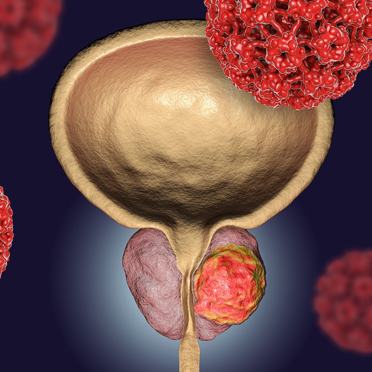 rendering of a bladder and prostate