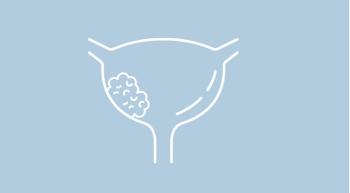  Urothelial Carcinoma