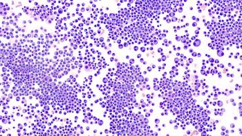 Image of multiple myeloma cells
