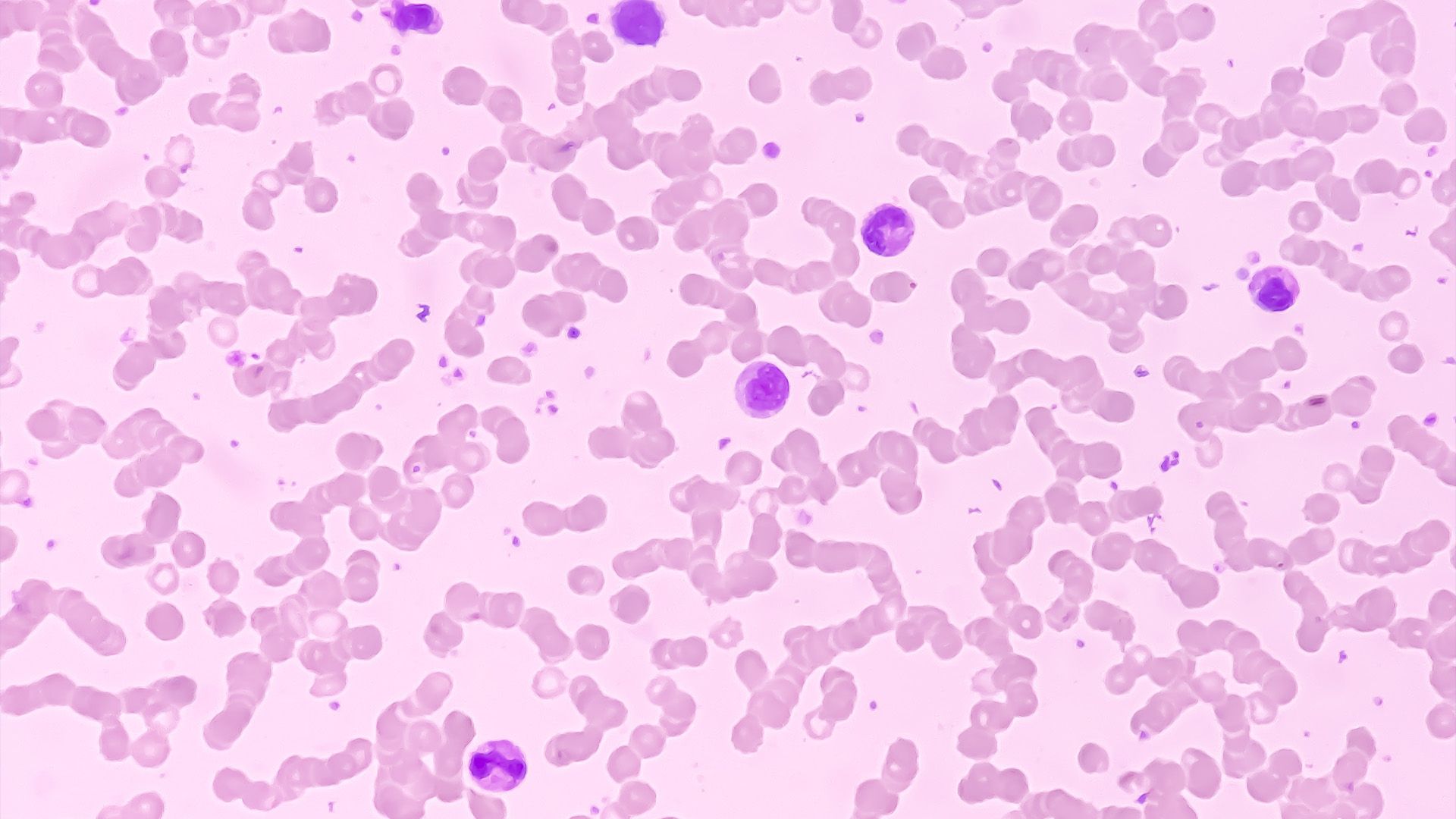 Image of bone marrow cells