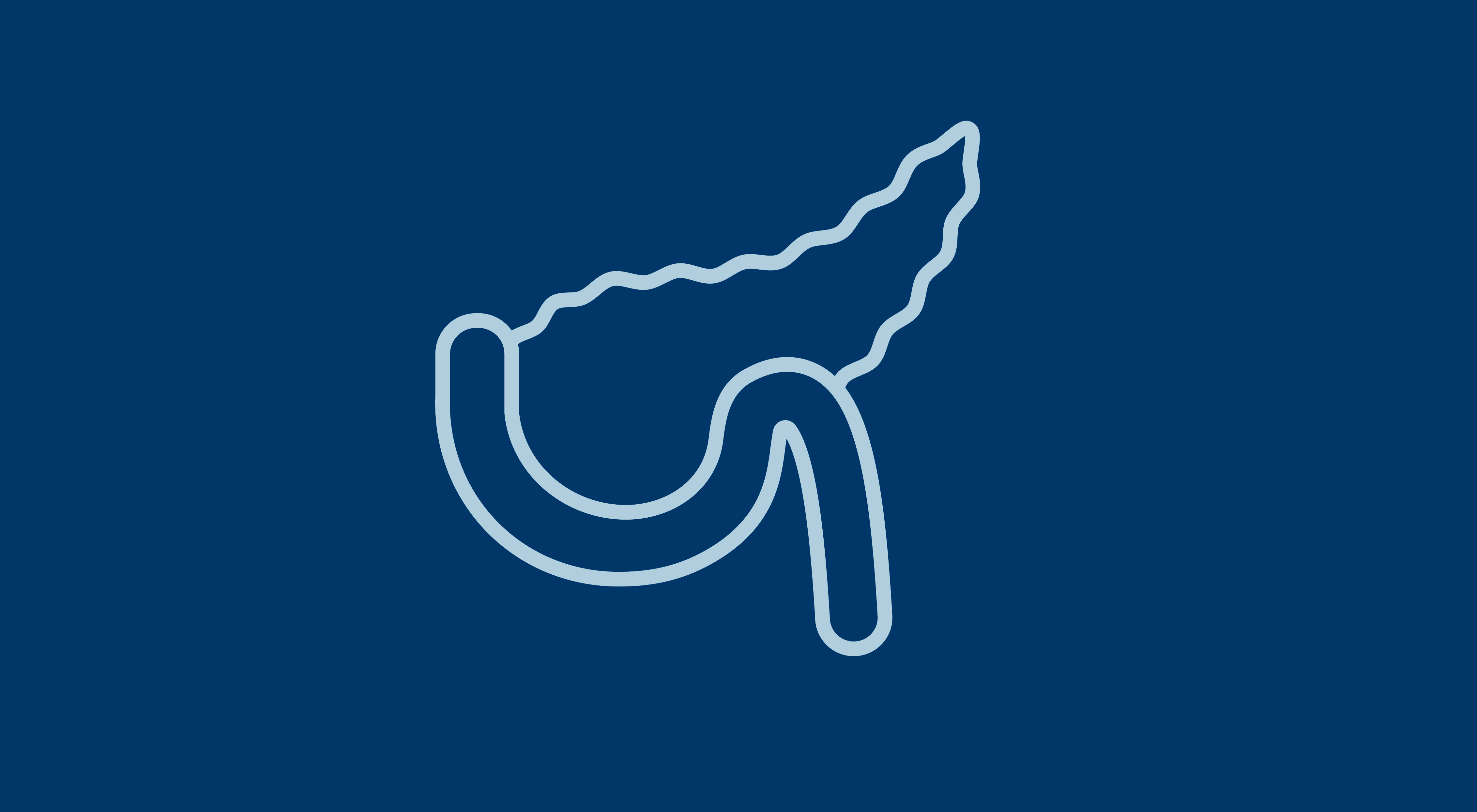 Pancreatic Ductal Adenocarcinoma