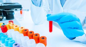 test tubes, one of which is being held by a person with a white lab coat