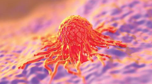 cervical cancer