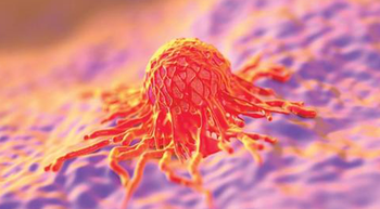 cervical cancer