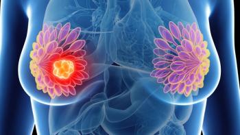 Image of a breast with a tumor