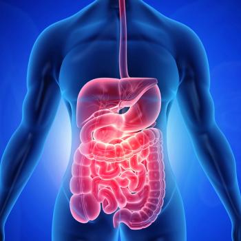 Colorectal cancer