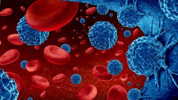 Image of blood cells with lymphoma cells