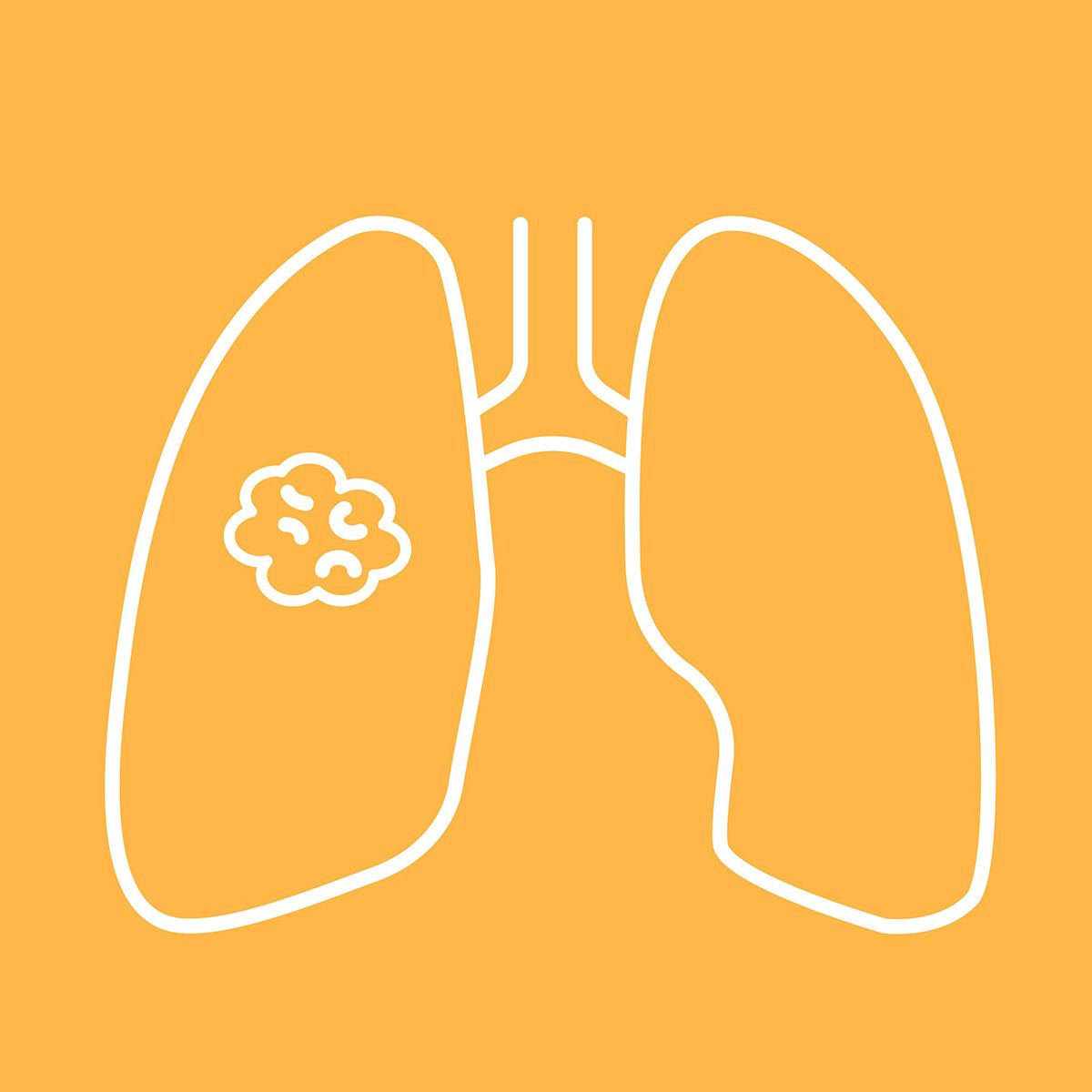 Line illustration of lungs with a tumor in the left lung