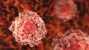 Image of a leukemia cell