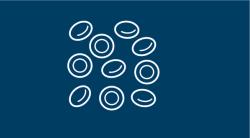 Frontline Zanubrutinib/Rituximab, Short-Course R-DHAOx Elicits Preliminary Results in Mantle Cell Lymphoma