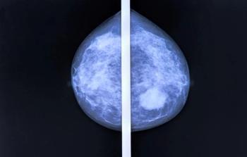 Breast Image 