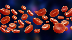 Luspatercept Linked With Maintained Reduction in Transfusion Dependence Among Patients With β-Thalassemia