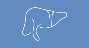 Side Effects From Regorafenib May Lead to Discontinuation in uHCC With Poor Liver Function