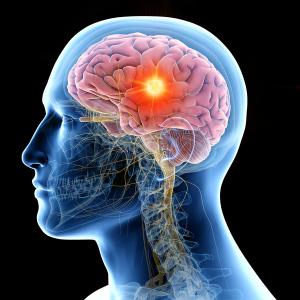 Anatomical graphic of a person with a highlighted brain tumor