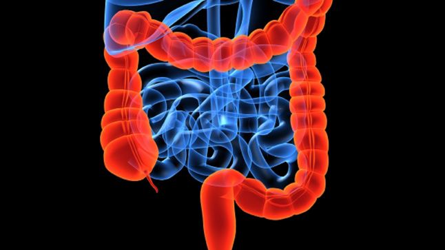 Image with a black background of a blue gastrointestinal tract with the colon highlighted in bright red.